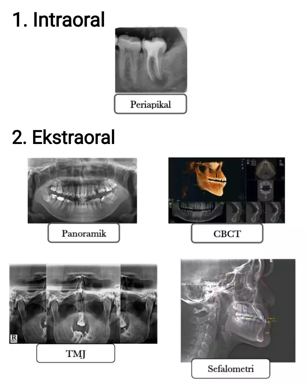  Dental Radiograf  sebagai Penunjang Dental Diagnostic