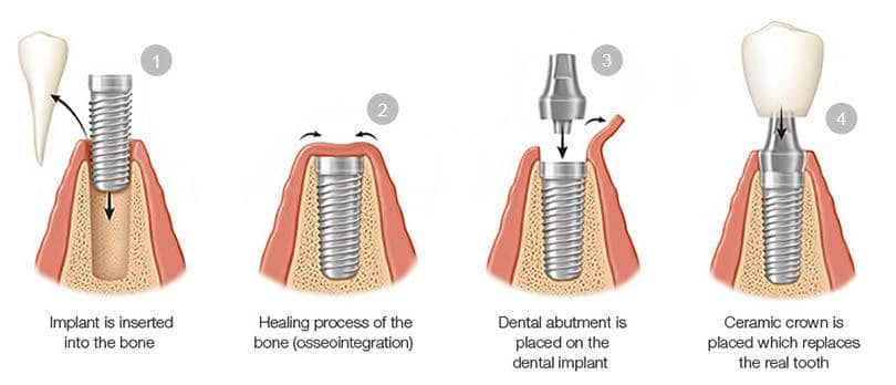Endodontist